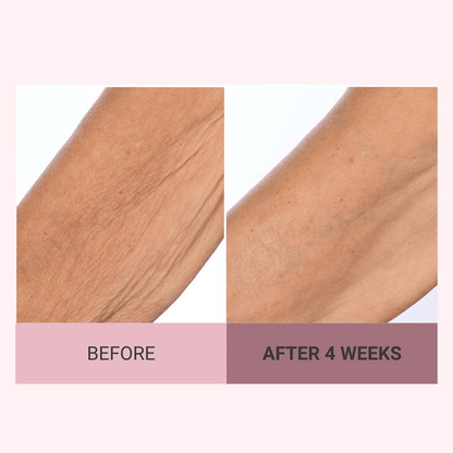 👨‍⚕️ Made and Shipped from US🏆 10,000 Sold This Month✨🎁 Champagne Beaute Lift Firming Body Crème🏆️Collagen regeneration✈Fast Worldwide Shipping
