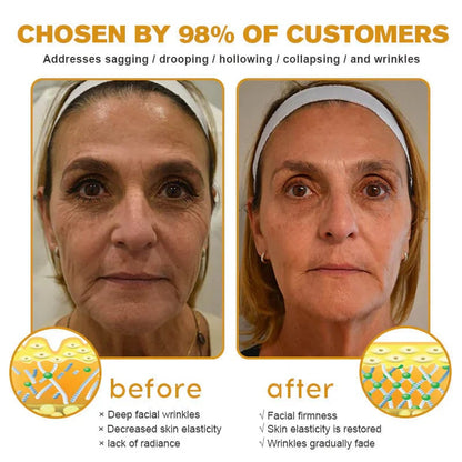 👨‍⚕️ Made and Shipped from US🏆 10,000 Sold This Month✨🎁✅  Botox Bee Venom Wrinkle Removal Cream