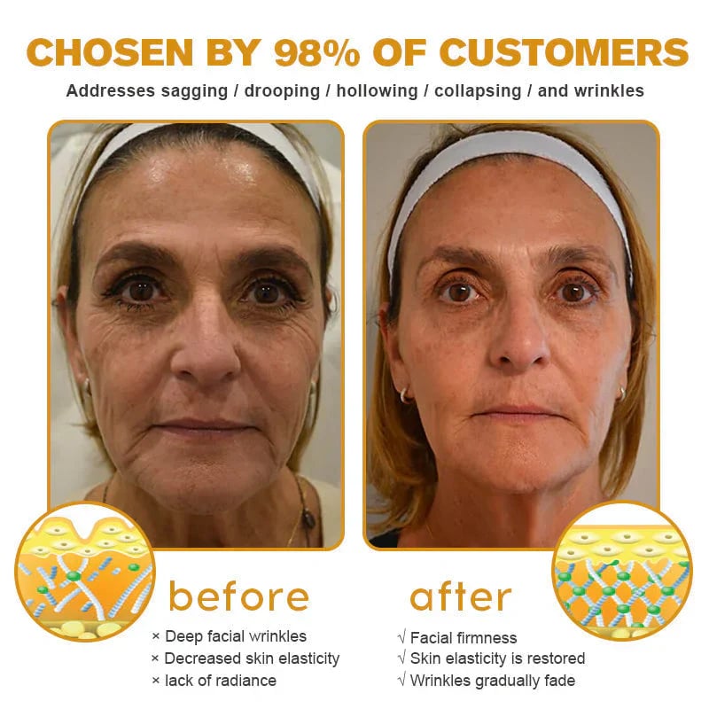 👨‍⚕️ Made and Shipped from US🏆 10,000 Sold This Month✨🎁✅ Virexo™ Bee Venom Wrinkle Removal Cream