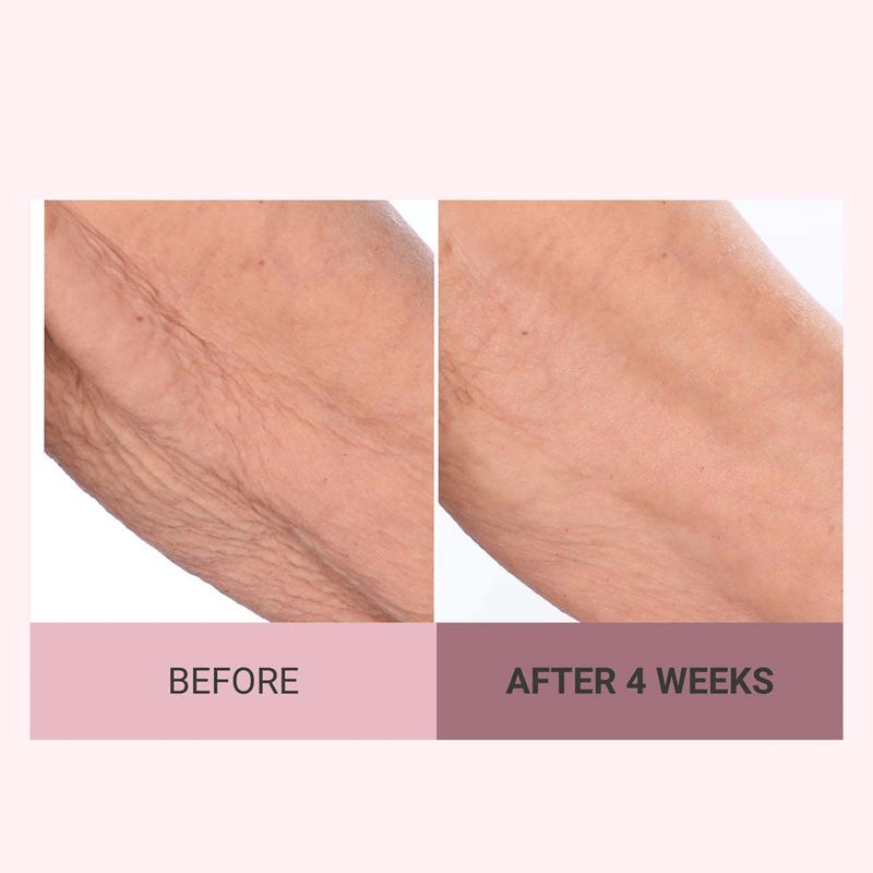👨‍⚕️ Made and Shipped from US🏆 10,000 Sold This Month✨🎁 Champagne Beaute Lift Firming Body Crème🏆️Collagen regeneration✈Fast Worldwide Shipping