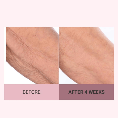 👨‍⚕️ Made and Shipped from US🏆 10,000 Sold This Month✨🎁 Champagne Beaute Lift Firming Body Crème🏆️Collagen regeneration✈Fast Worldwide Shipping